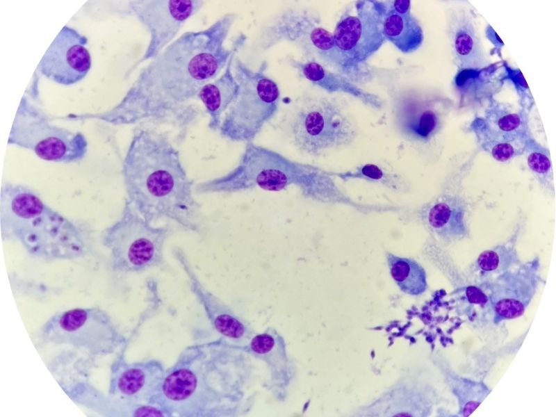 view through a microscope